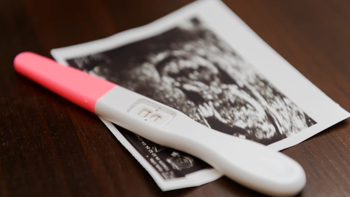 Mulheres descobrem gravidez no parto: entenda a gestação 'silenciosa'