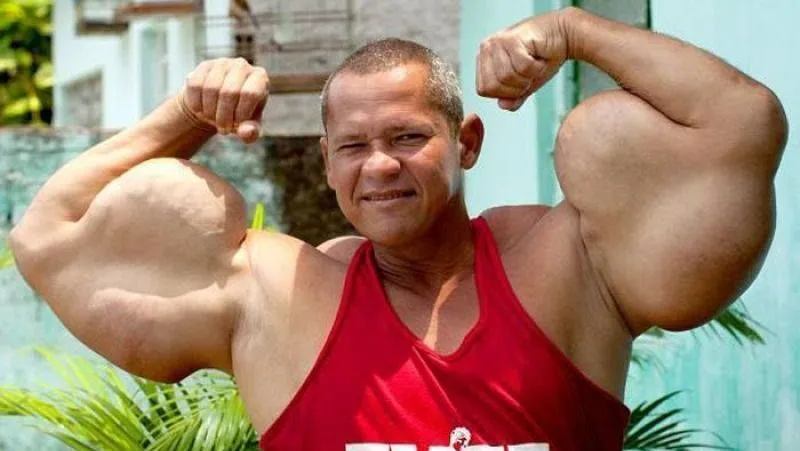 “Popeye brasileiro” morre aos 55 anos no Recife